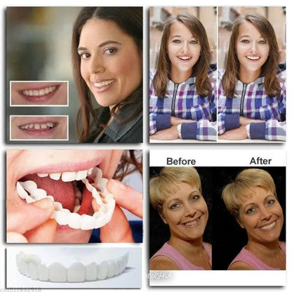 Adjustable Snap-On Dentures